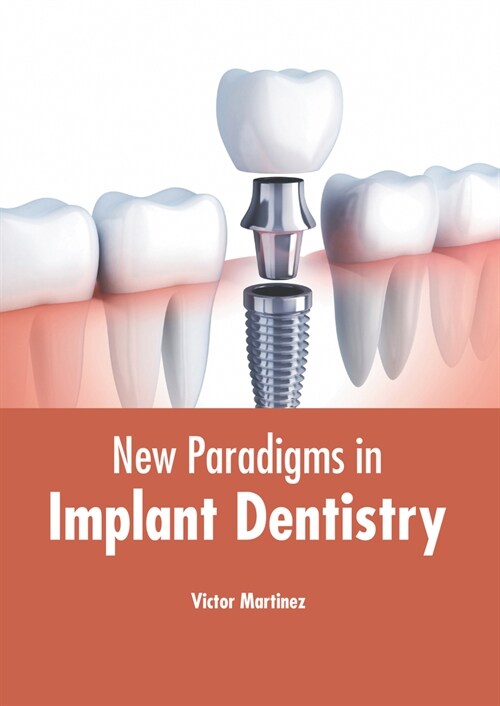 New Paradigms in Implant Dentistry (Hardcover)