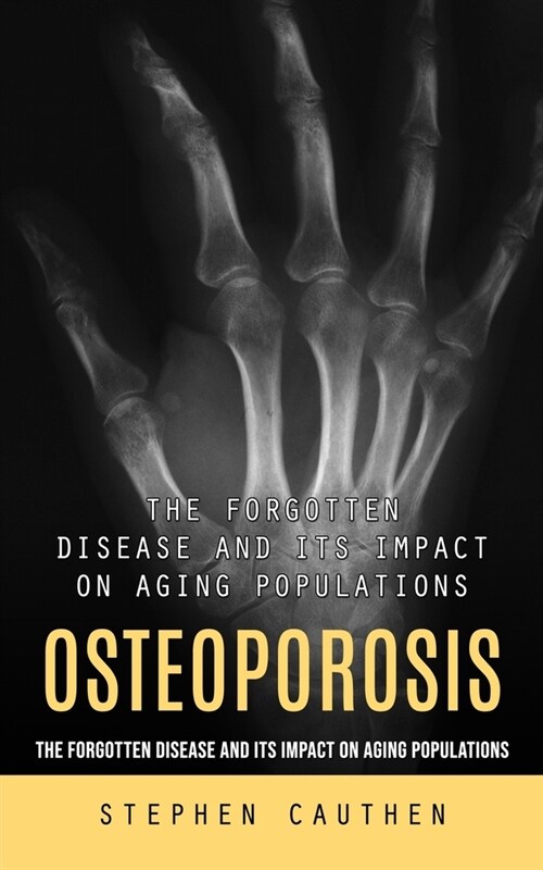 Osteoporosis: Quick and Effective Remedy for Stronger Bones (The Forgotten Disease and Its Impact on Aging Populations) (Paperback)