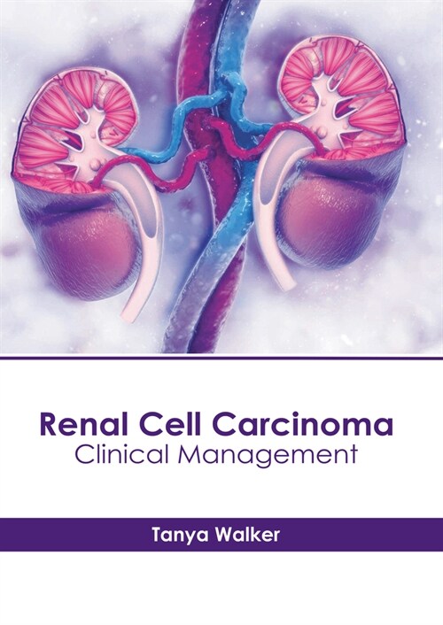 Renal Cell Carcinoma: Clinical Management (Hardcover)