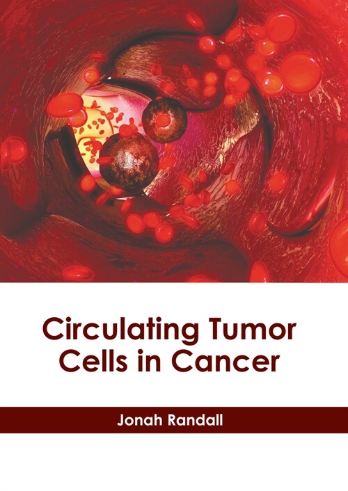 Circulating Tumor Cells in Cancer (Hardcover)