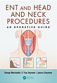 ENT and Head and Neck Procedures : An Operative Guide (Paperback)