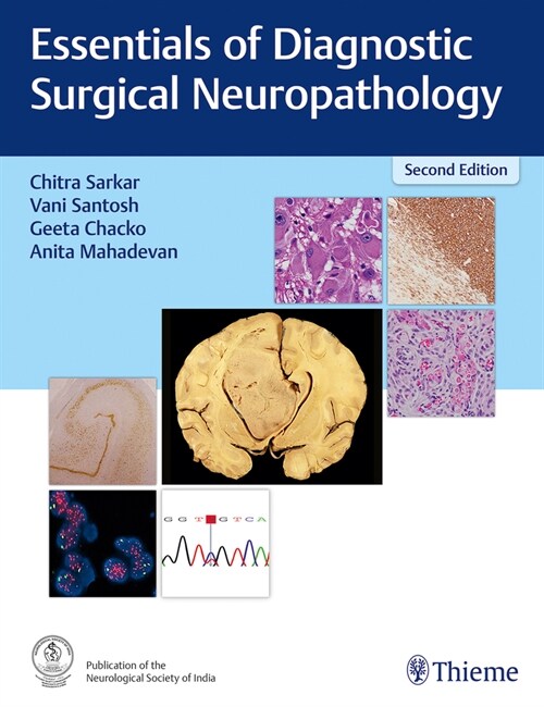 Essentials of Diagnostic Surgical Neuropathology (Hardcover)