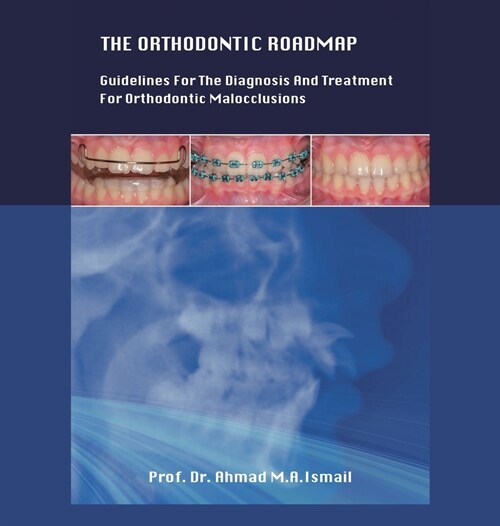 The Orthodontic Roadmap: Guidelines for the Diagnosis and Treatment of Orthodontic Malocclusions (Hardcover)