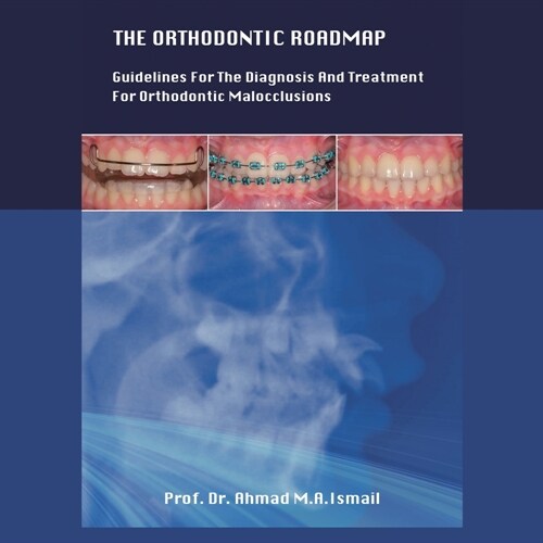 The Orthodontic Roadmap: Guidelines for the Diagnosis and Treatment of Orthodontic Malocclusions (Paperback)