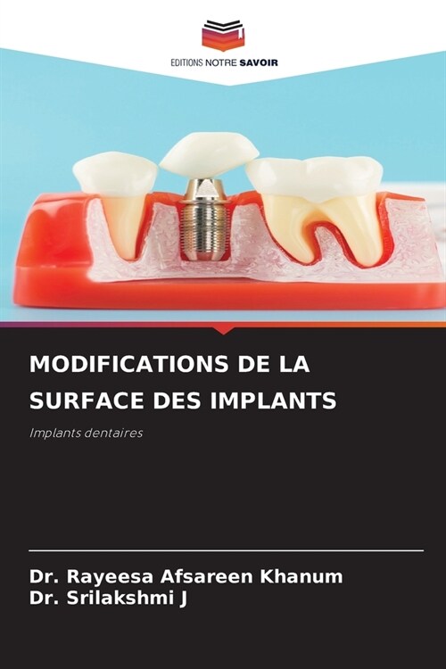 Modifications de la Surface Des Implants (Paperback)