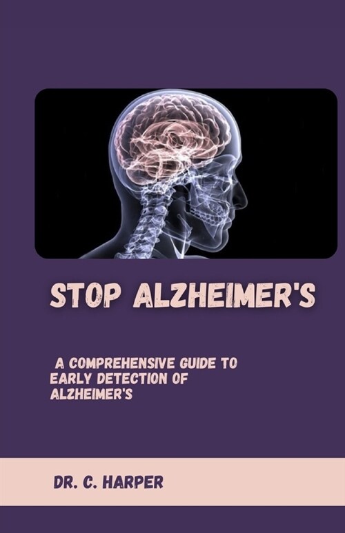 Stop Alzheimers: A Comprehensive Guide to Early Detection of Alzheimers (Paperback)