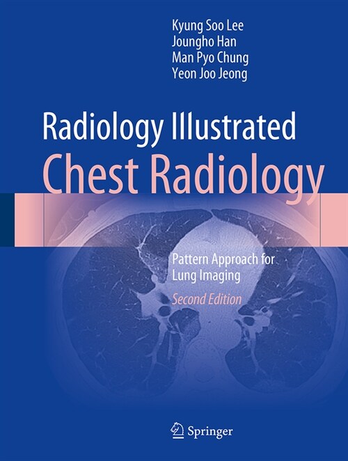 Radiology Illustrated: Chest Radiology: Pattern Approach for Lung Imaging (Hardcover, 2, 2023)