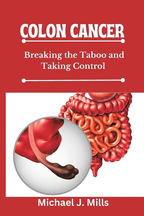 Colon Cancer: Breaking the Taboo and Taking Control (Paperback)