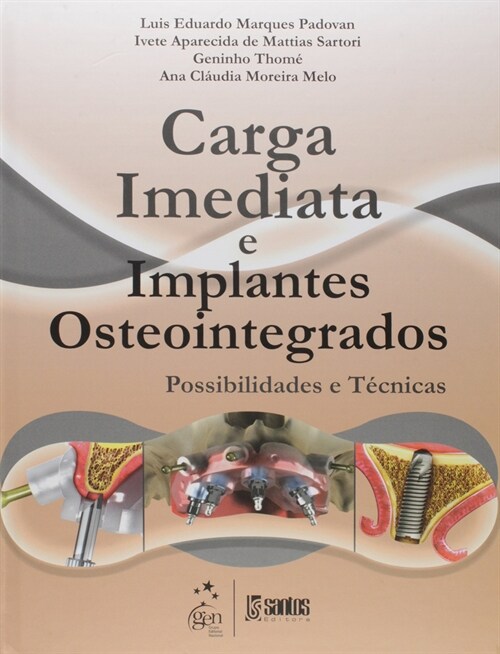  Carga Imediata e Implantes Osseointegrados - Possibilidades e Tecnicas - 1ª/2008