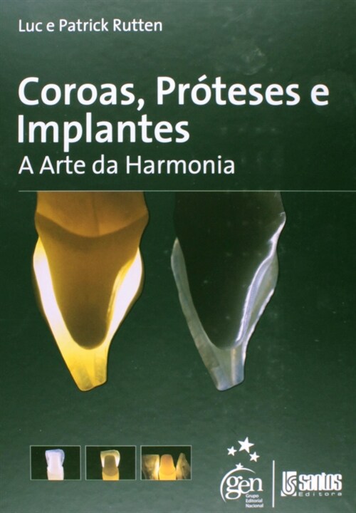  Coroas, Proteses e Implantes - A Arte da Harmonia - 1ª/2008