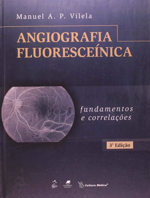  Angiografia Fluoresce nica - Fundamentos e CorrelaCoes - 3ª/2011