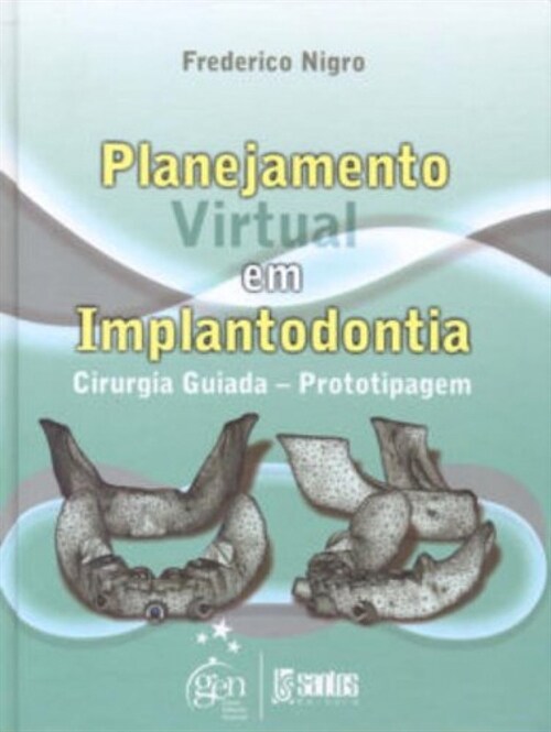  Planejamento Virtual em Implantodontia - Cirurgia - 1ª/2009