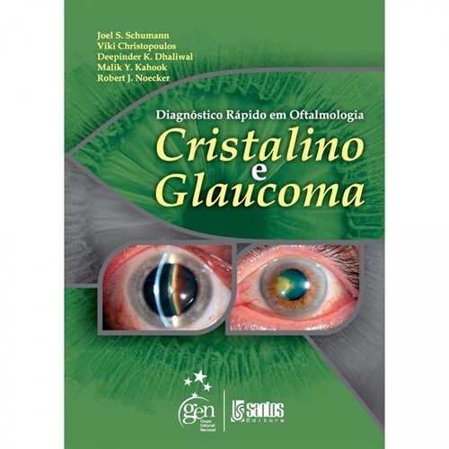 Diagnostico Rapido em Oftalmologia - Cristalino e Glaucoma - 1ª/2009