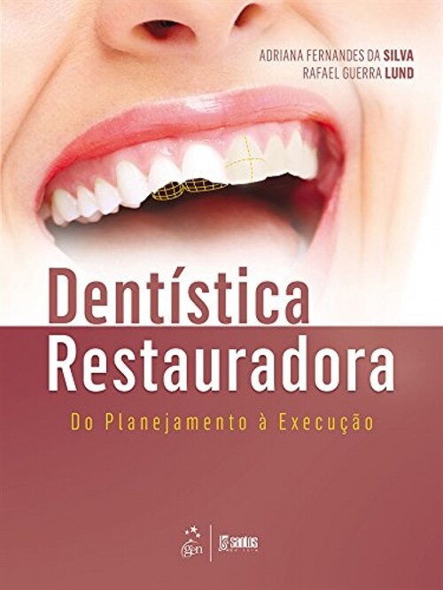  Dentistica Restauradora - Do Planejamento a ExecuCao - 1ª/2016