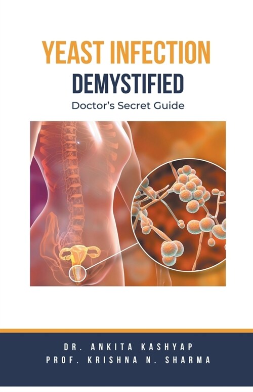 Yeast Infection: Demystified Doctors Secret Guide (Paperback)