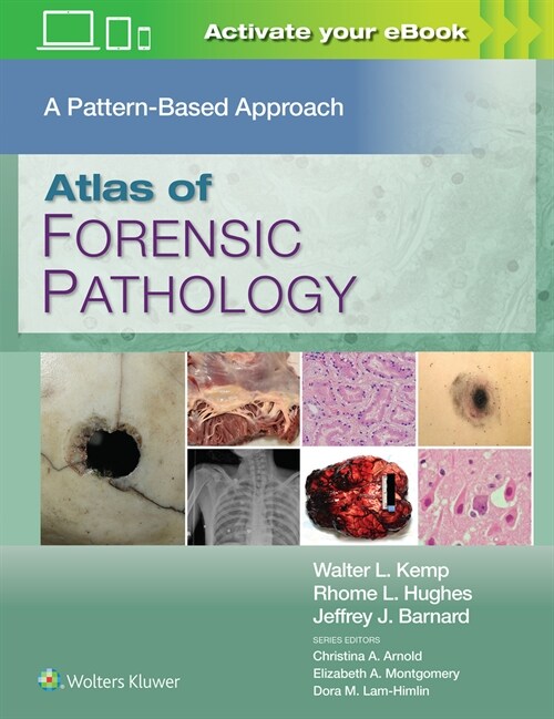 Atlas of Forensic Pathology: A Pattern Based Approach: Print + eBook with Multimedia (Hardcover)