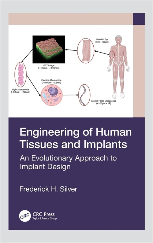 Engineering of Human Tissues and Implants : An Evolutionary Approach to Implant Design (Hardcover)