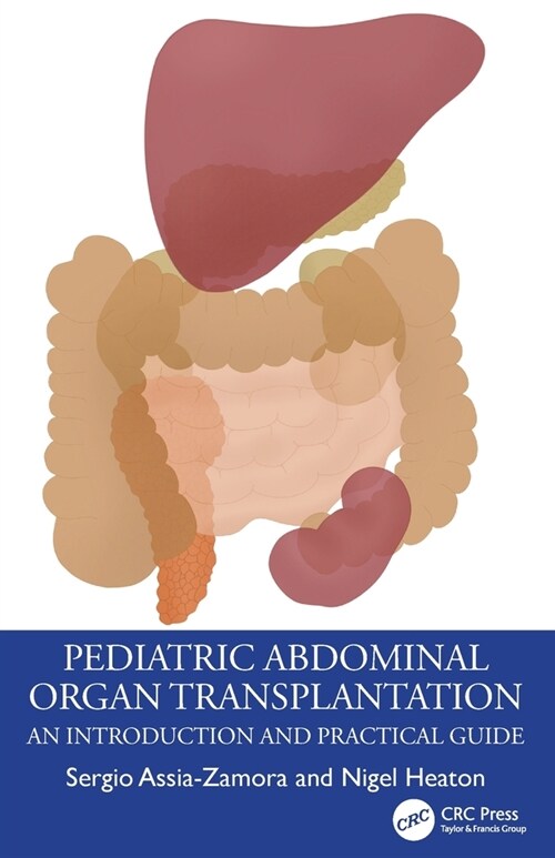 Pediatric Abdominal Organ Transplantation : An Introduction and Practical guide (Paperback)