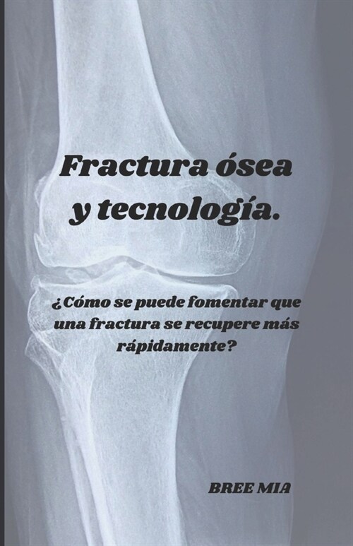 Fractura ?ea y tecnolog?.: 풠?o se puede fomentar que una fractura se recupere m? r?idamente? (Paperback)