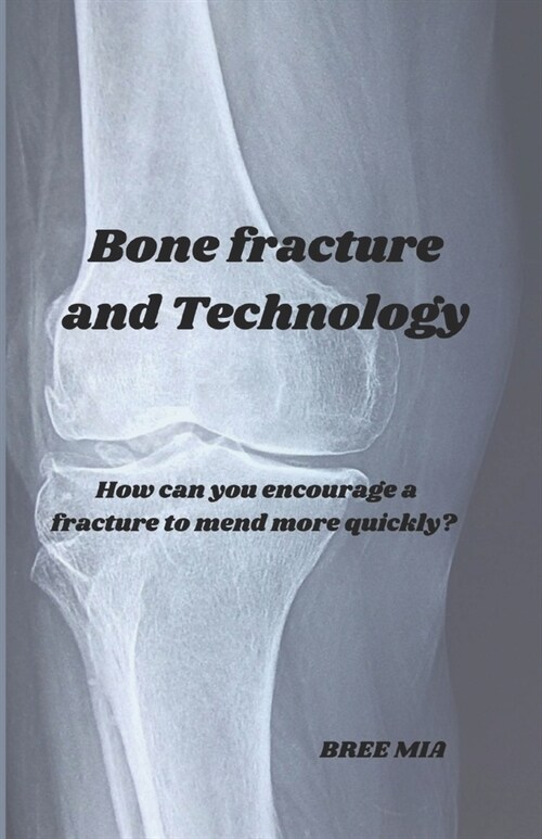 Bone fracture and Technology: How can you encourage a fracture to mend more quickly? (Paperback)