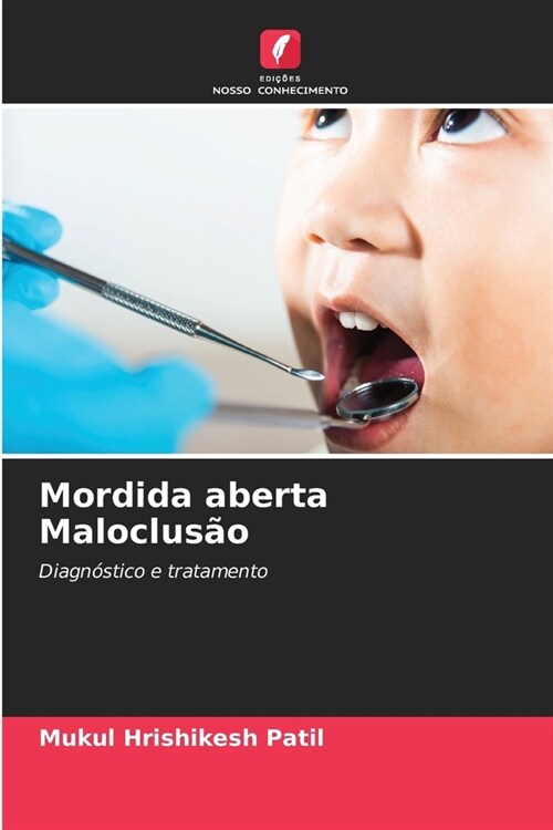 Mordida aberta Maloclus? (Paperback)