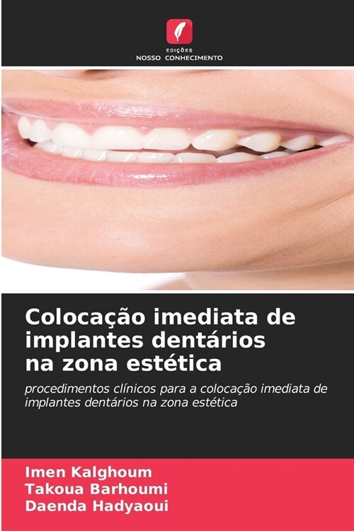 Coloca豫o imediata de implantes dent?ios na zona est?ica (Paperback)