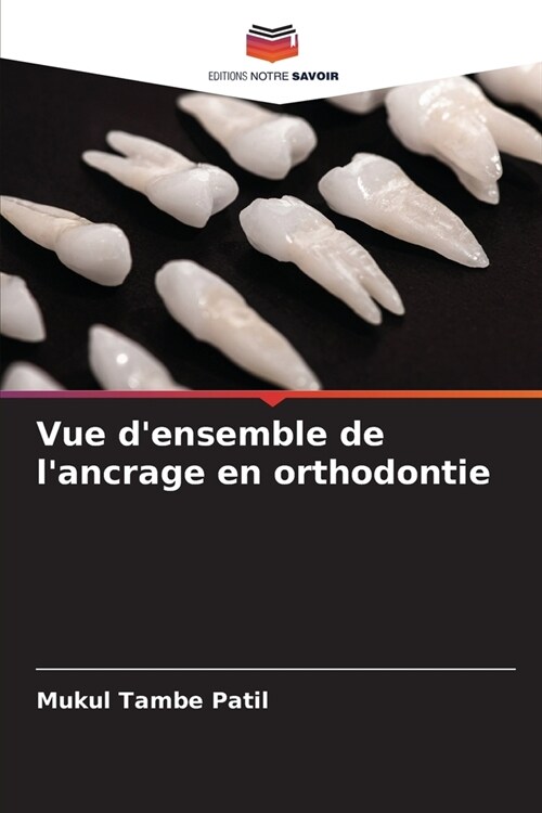 Vue densemble de lancrage en orthodontie (Paperback)