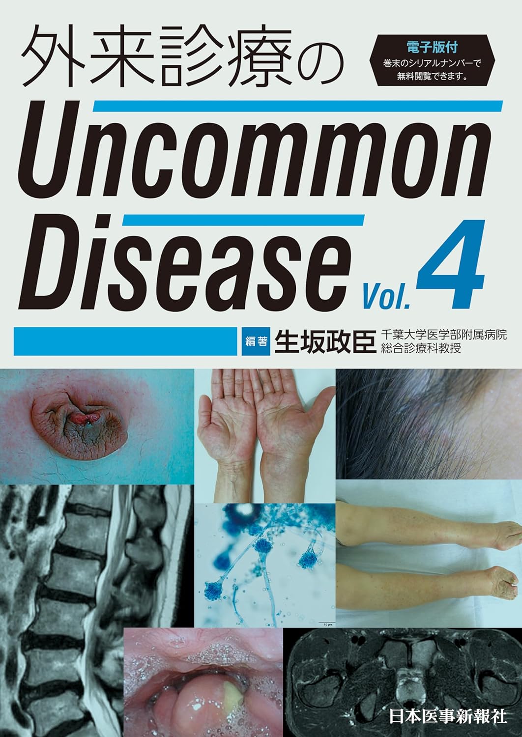 外來診療のUncommon Disease vol.4