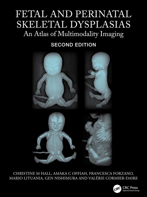 Fetal and Perinatal Skeletal Dysplasias : An Atlas of Multimodality Imaging (Hardcover, 2 ed)