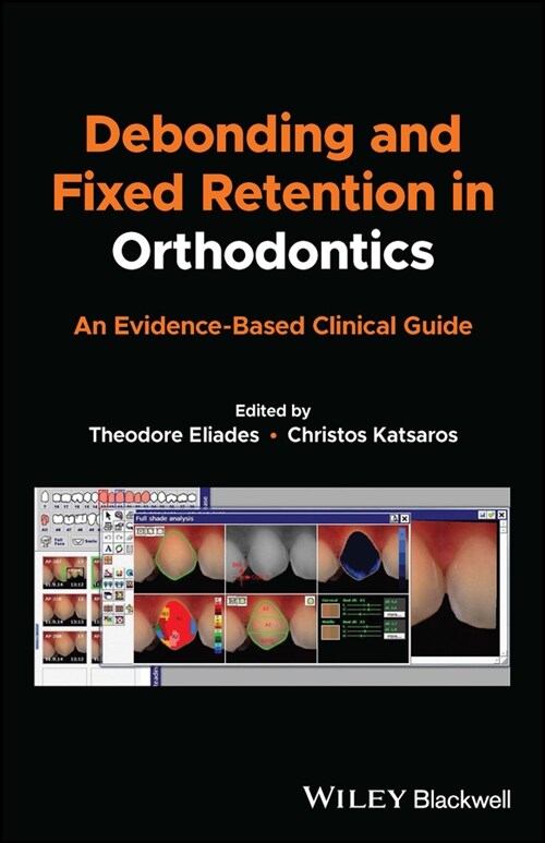 [eBook Code] Debonding and Fixed Retention in Orthodontics (eBook Code, 1st)