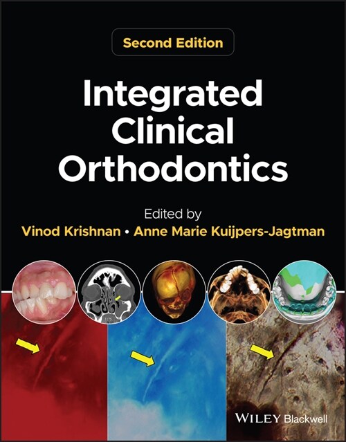 [eBook Code] Integrated Clinical Orthodontics (eBook Code, 2nd)