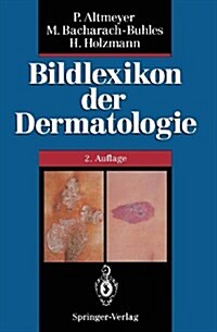 Bildlexikon Der Dermatologie (Paperback, 2, 2. Aufl. 1995.)
