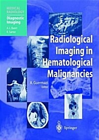 Radiological Imaging in Hematological Malignancies (Paperback, Softcover Repri)