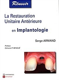 La Restauration Unitaire Ant굍ieure En Implantologie (Paperback)