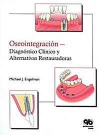 Oseointegraci줻 (Paperback, Spiral)