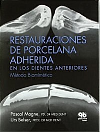 Restauraciones de Porcelana Adherida en los Dientes Anteriores (Paperback)