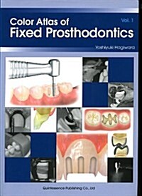 Color Atlas of Fixed Prosthodontics (Paperback, 1st)