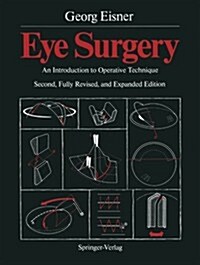 Eye Surgery: An Introduction to Operative Technique (Paperback, 2, 1990. Softcover)
