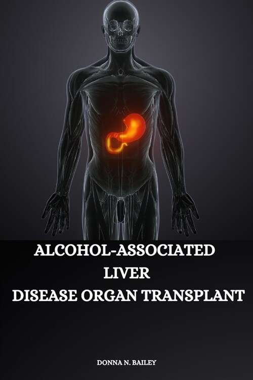Alcohol-associated liver disease organ transplant (Paperback)