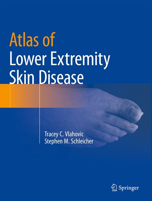 Atlas of Lower Extremity Skin Disease (Paperback, 2022)