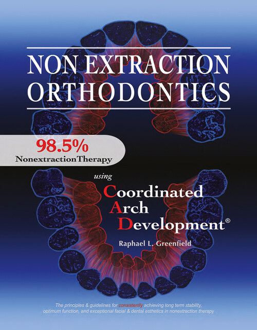 Non Extraction Orthodontics