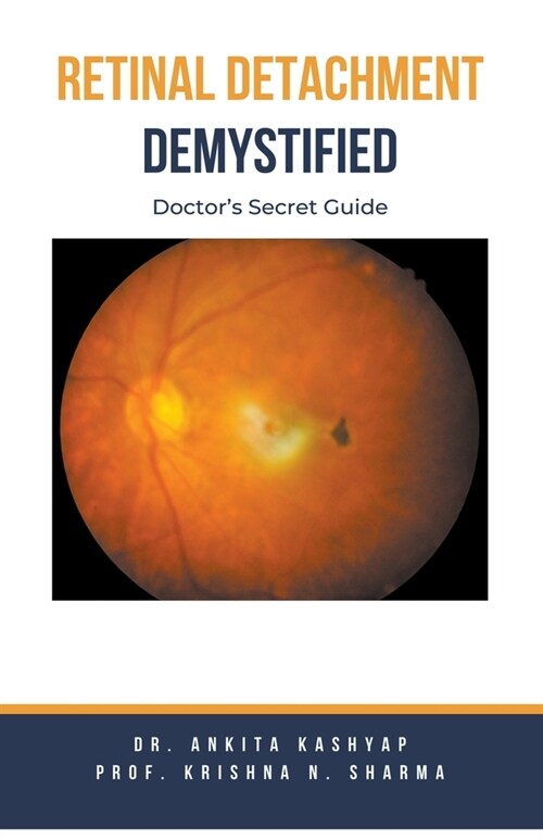 Retinal Detachment Demystified: Doctors Secret Guide (Paperback)