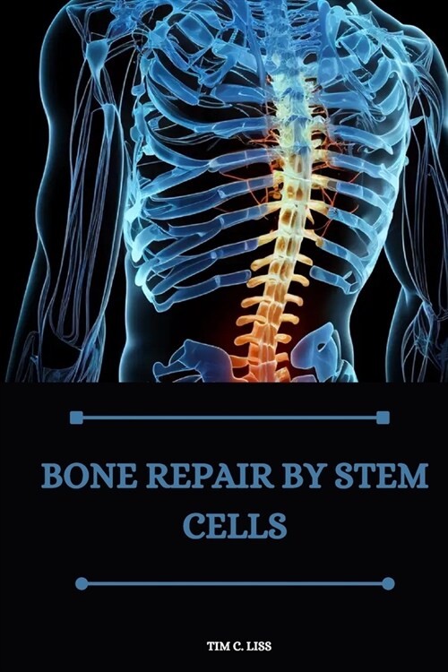 Bone repair by stem cells (Paperback)