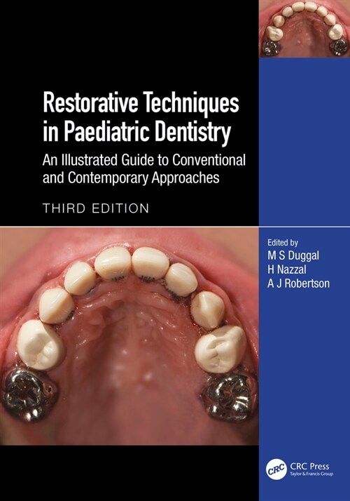 Restorative Techniques in Paediatric Dentistry : An Illustrated Guide to Conventional and Contemporary Approaches (Hardcover, 3 ed)