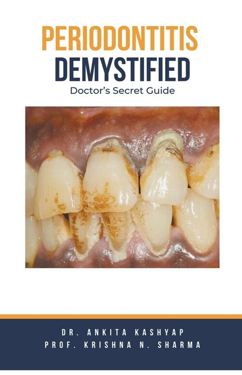 Periodontitis Demystified: Doctors Secret Guide (Paperback)