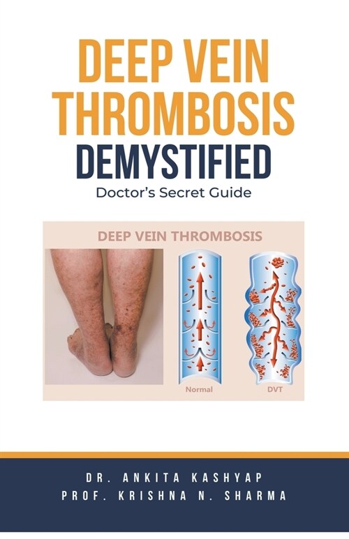 Deep Vein Thrombosis Demystified: Doctors Secret Guide (Paperback)