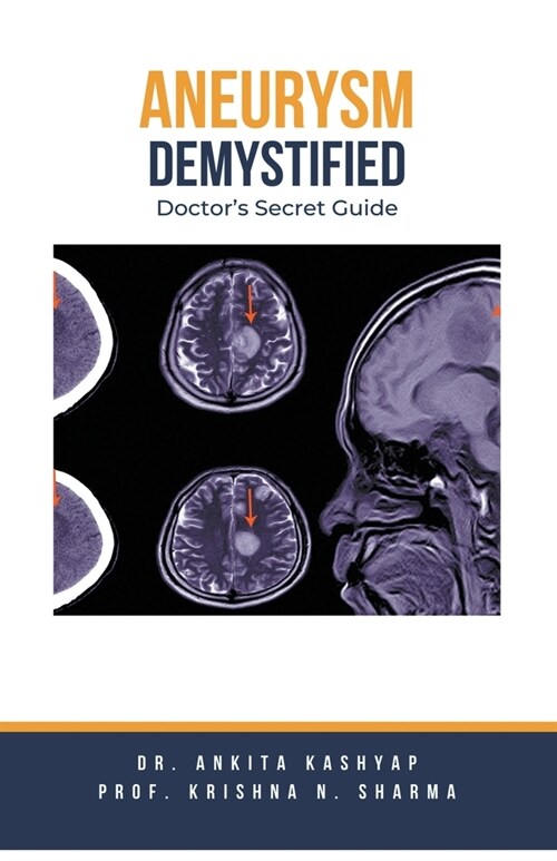 Aneurysm Demystified: Doctors Secret Guide (Paperback)