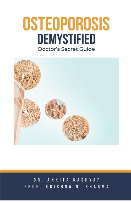 Osteoporosis Demystified: Doctors Secret Guide (Paperback)