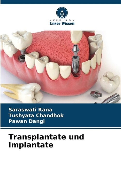 Transplantate und Implantate (Paperback)