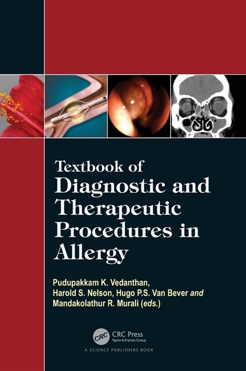 Textbook of Diagnostic and Therapeutic Procedures in Allergy (Hardcover, 1)